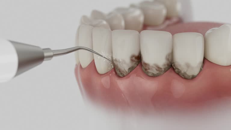 Trusted Wisdom Tooth Removal service in St. Croix Falls, WI - Dentist Open Now
